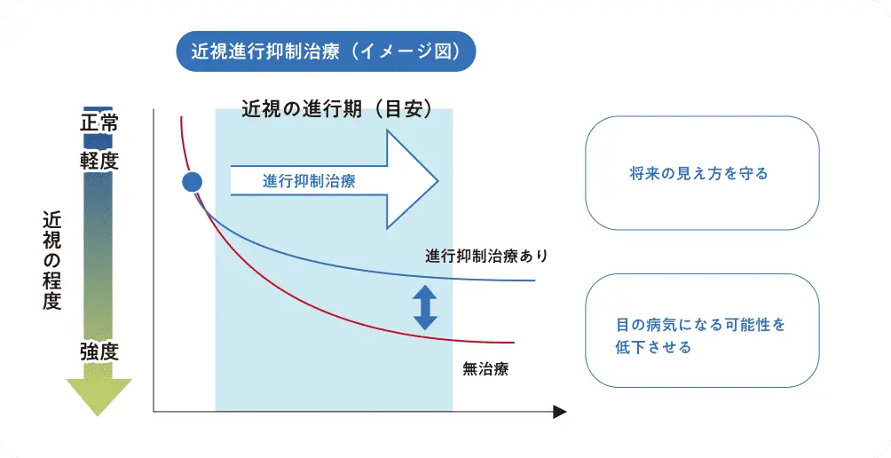 近視の進行イメージ図